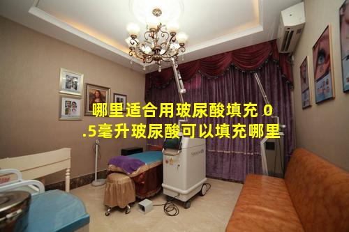 哪里适合用玻尿酸填充 0.5毫升玻尿酸可以填充哪里